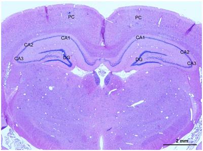 Dl-3-n-Butylphthalide Treatment Enhances Hemodynamics and Ameliorates Memory Deficits in Rats with Chronic <mark class="highlighted">Cerebral Hypoperfusion</mark>